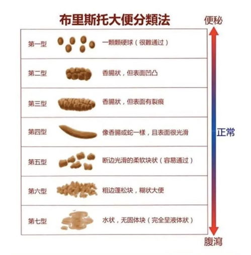 为什么每天梦到大便呢呢,解梦自查梦见大便是什么意思