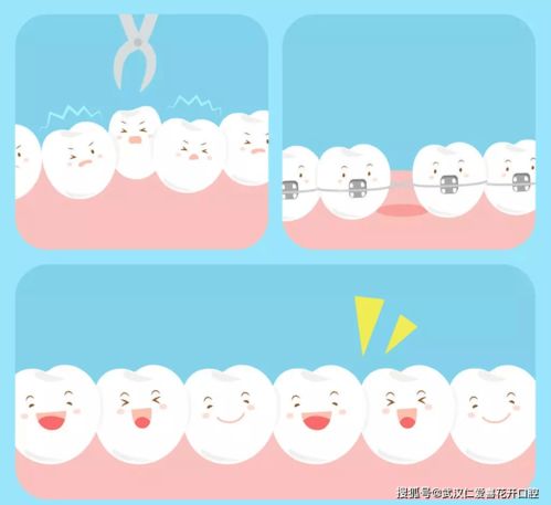 为什么梦到拔牙齿了呢,梦见把牙齿拔掉了有什么征兆