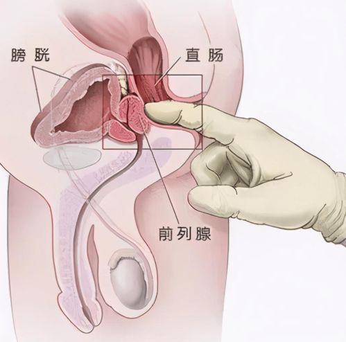 凌晨梦到肛门疼什么意思,梦见屁股疼的预兆