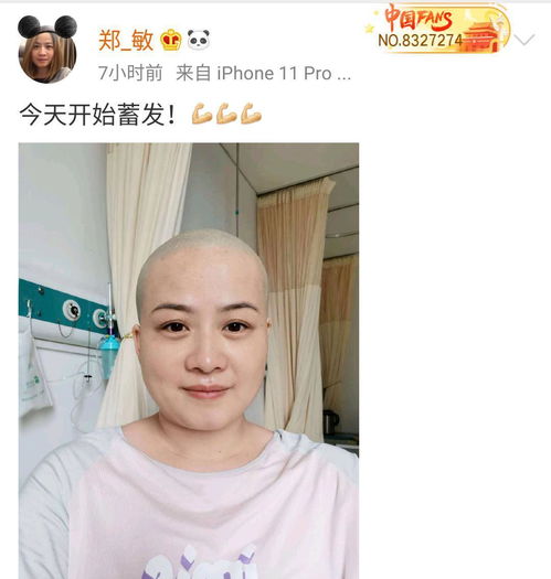 学生梦到剪光头什么意思,梦见剃光头是什么意思