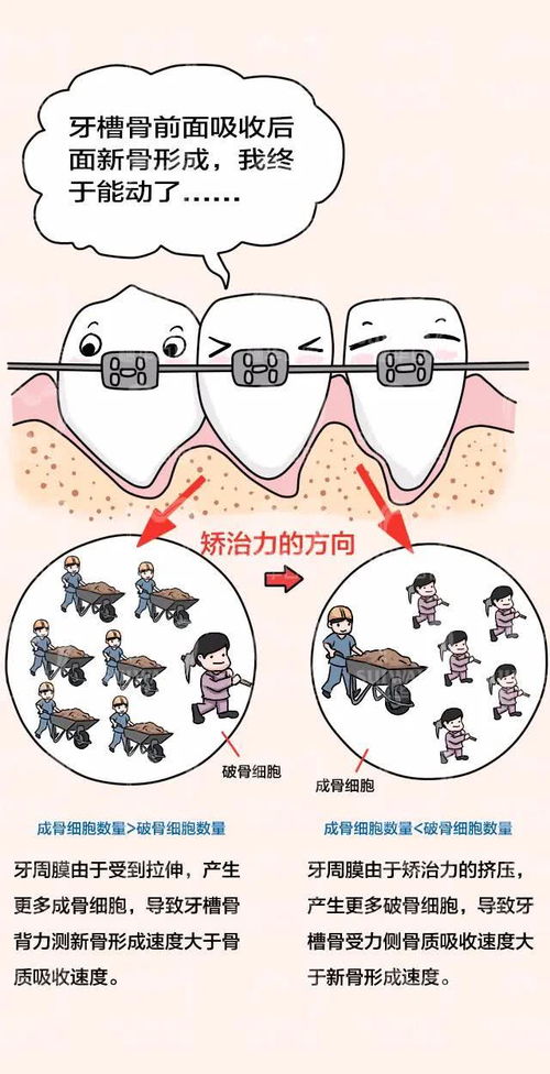 梦到下齿松动什么意思,梦见下牙松的预兆