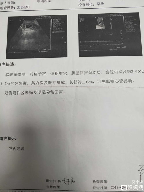 怀孕梦到长粑粑什么预兆,怀孕梦见大便是什么意思？