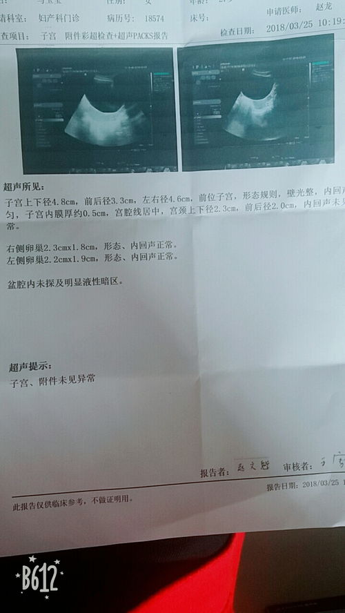 怀孕梦到生化了什么预兆,孕早期做梦梦见生化了