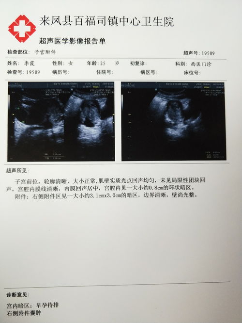 早孕梦到火烧人什么意思,梦见火烧人