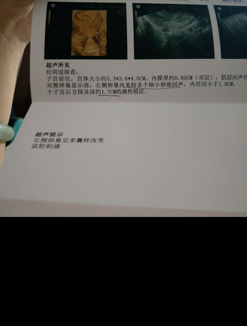 怀孕梦到拿银子什么征兆,孕妇梦见银元是什么意思？