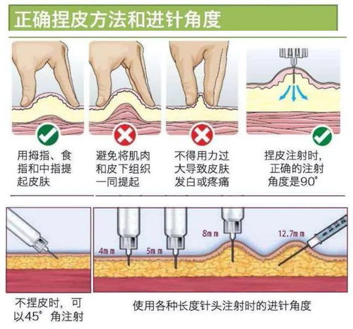 昨晚梦到小腹打针什么意思,梦见打针是什么预兆