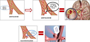 梦到人中裂缝是什么预兆,梦见裂缝的预兆